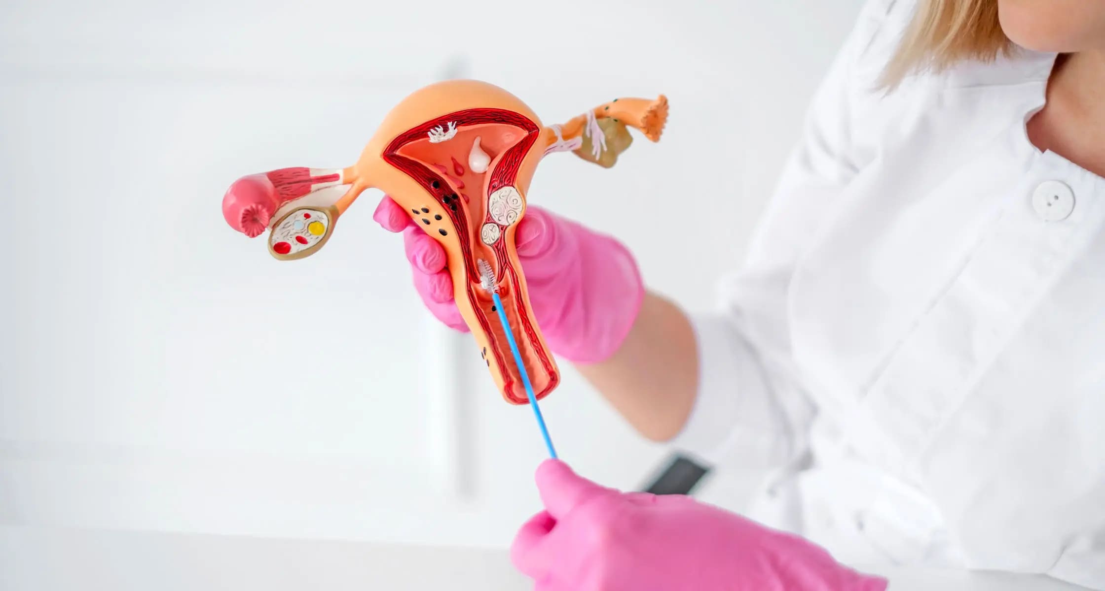 Cervical Cancer Screening