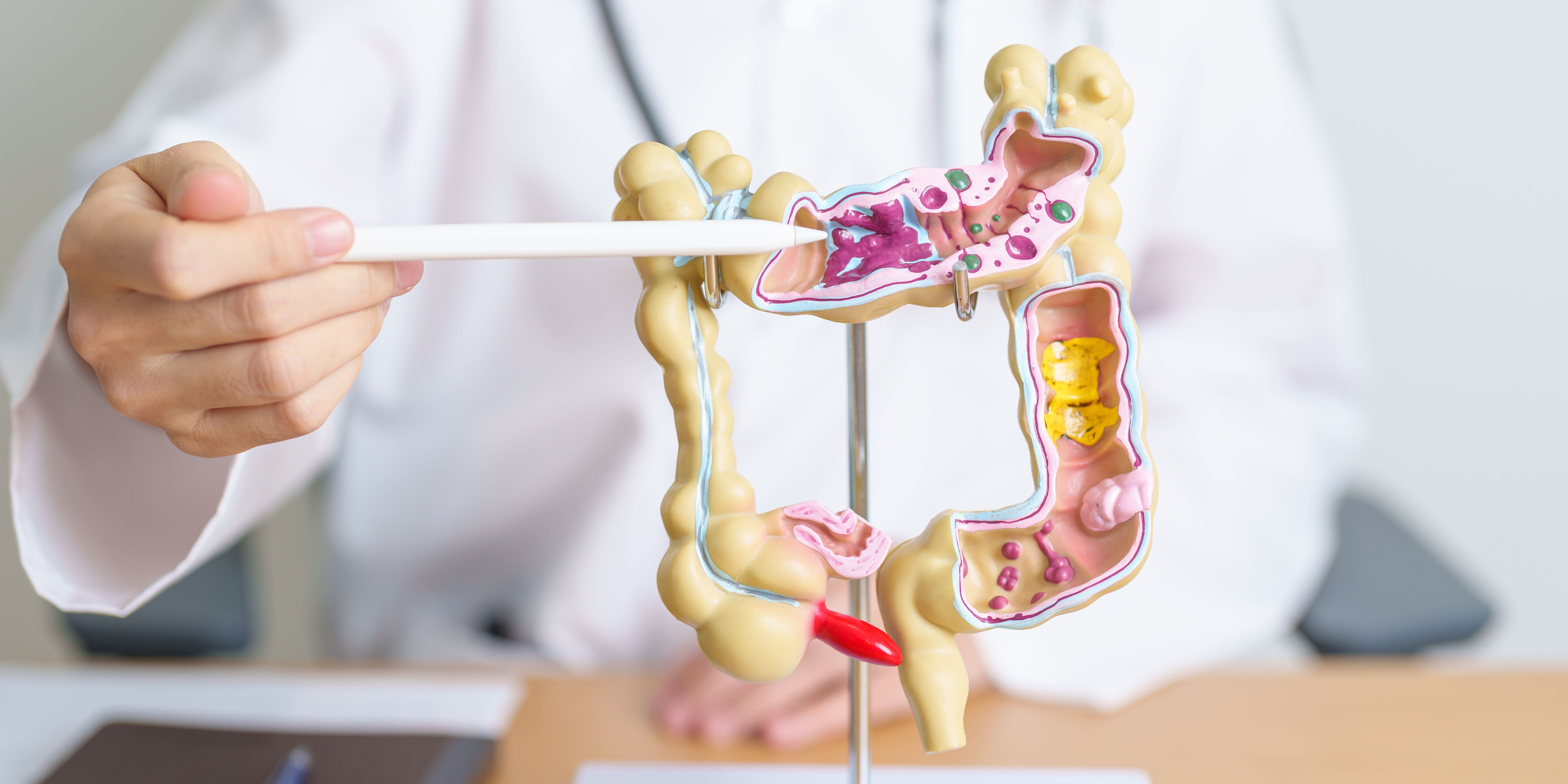 Colon Cancer Screening
