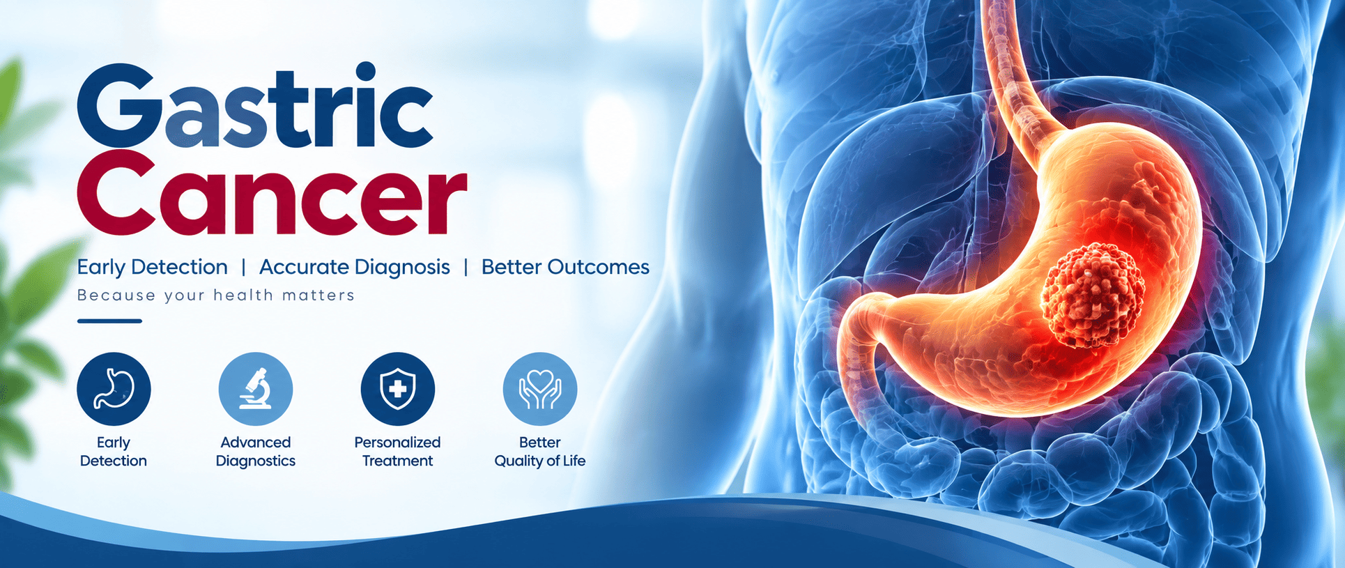Gastric Cancer